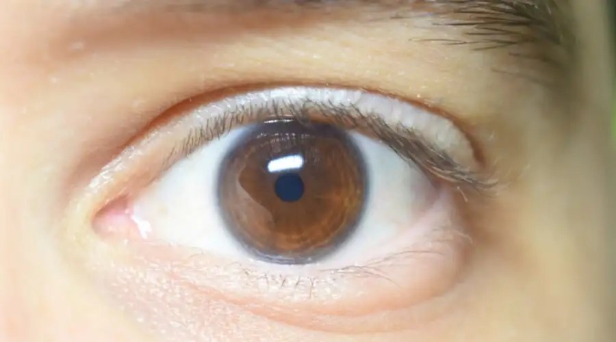 الولايات المتحدة.. سحب ملايين قطرات العين