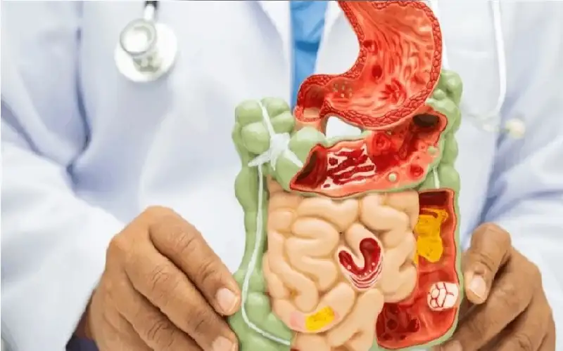 كيف يعيد النظام الغذائي برمجة الميكروبيوم