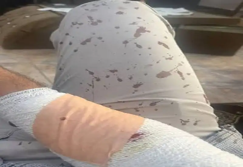صحيفة نيسان ـ طالب يعتدي على معلم بـ منشار