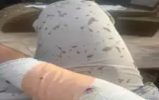 الأردن ـ طالب يعتدي على معلم بـ منشار