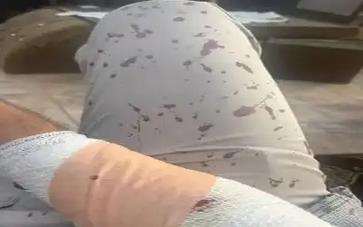 صحيفة نيسان ـ طالب يعتدي على معلم بـ منشار