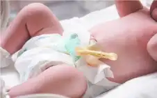 كيف يمكنك الاعتناء بمنطقة الحبل السري