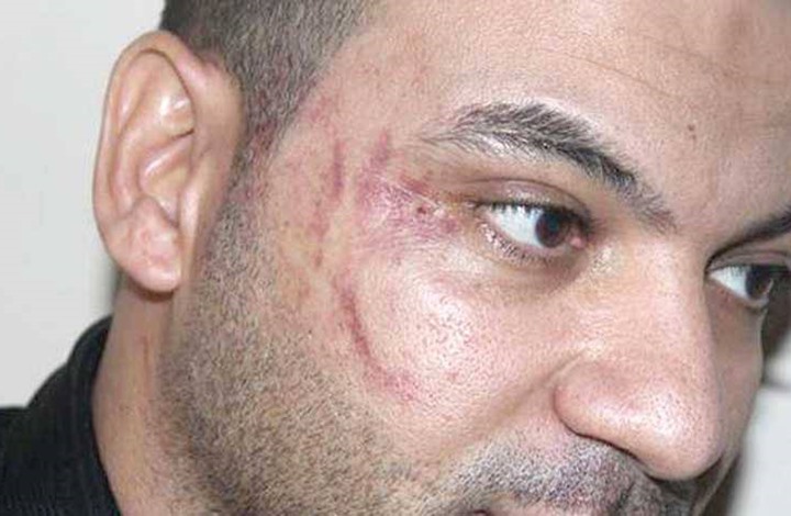 السفير المصري: النائب المعتدي على العامل