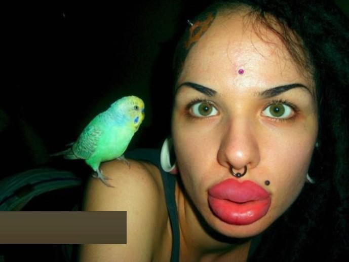 كلفة عمليات التجميل في السعودية تصل
