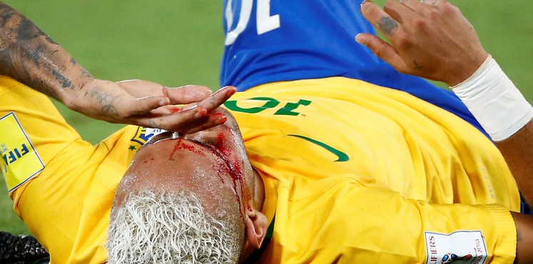 مدافع بوليفيا يكشف سبب اعتدائه على