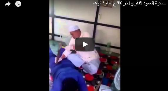 بالفيديو: معالج يداوي مرضى العمود الفقري