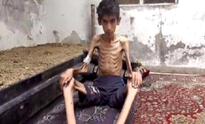 وفاة جديدة من الجوع في مضايا