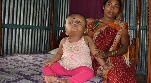 بالصور: الطفلة المعجزة تتحدى الأطباء في