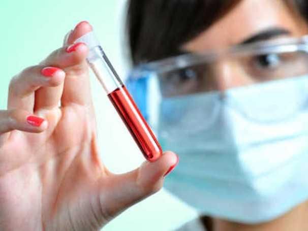 جديد الطب: فحص للدم يتنبأ بالوفاة