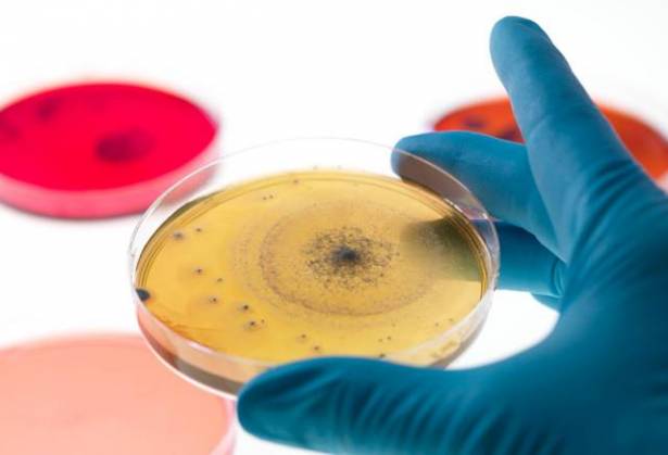 ماذا تعرفون عن بكتيريا السعادة؟