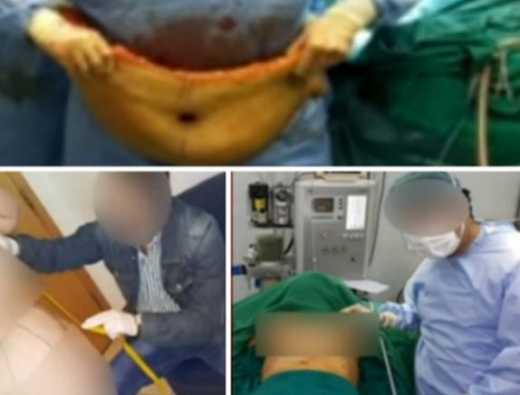 فيديو .. . طبيب تجميل عربي