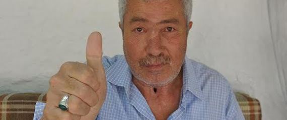 اصيب بـ 3 سرطانات بأقل من