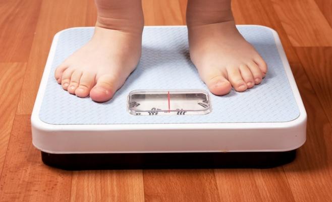 الإقبال على عمليات السمنة في الأردن