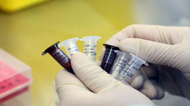 الاشتباه بإصابة 5 مواطنين بفيروس (H1N1)