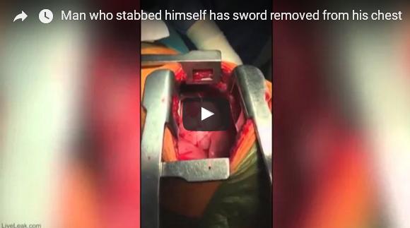 بالفيديو: جراحون إسبان يخرجون سيفا من