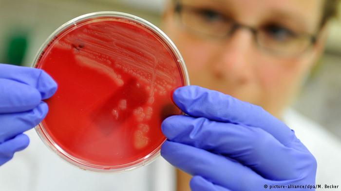 اكتشاف آلية مقاومة البكتيريا للمضادات يفتح