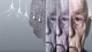 44 مليون شخص في العالم يتعرضون