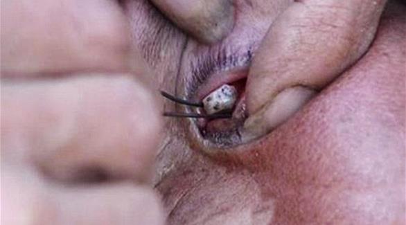 بالصور: صينية تذرف حجارة بدلا من