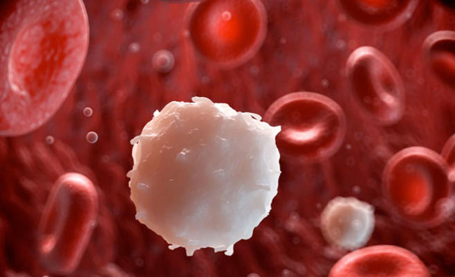 علاج جديد لسرطان الدم (يعطي نتائج