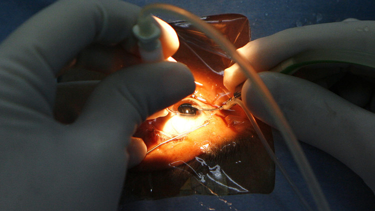 قرنية خنزير تعيد النظر لفتى صيني