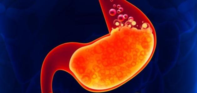 أعراض الحموضة الزائدة في الجسم وكيف