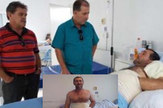 أطباء يزرعون يدا مصابة في معدة