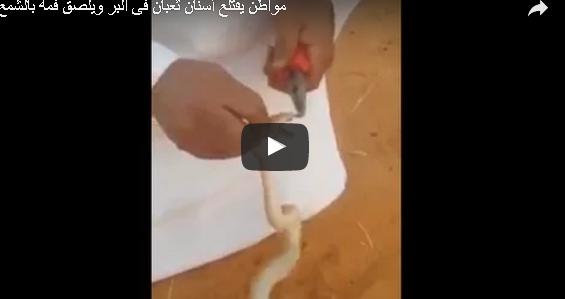 بالفيديو: سعودي يقتلع أسنان ثعبان.. وصديقه