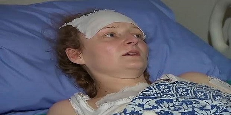 أم روسية تفقد قدمها وذراعها لحماية
