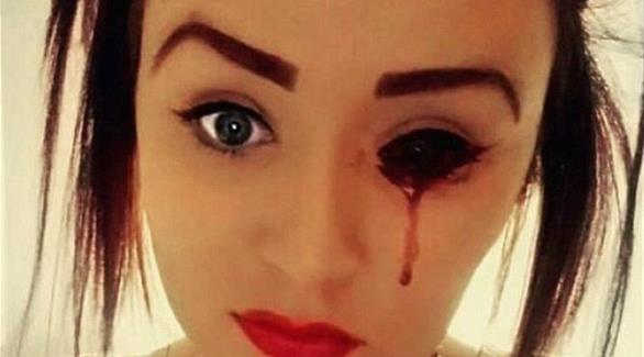بالصور: فتاة تنزف من جميع أنحاء
