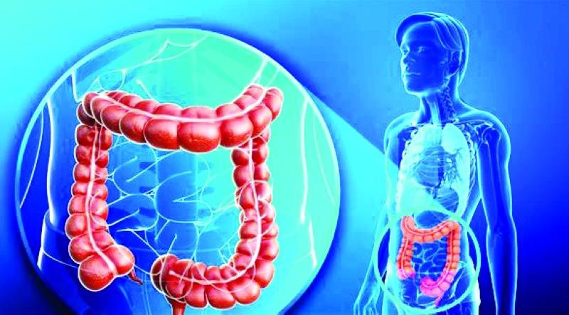 الكشف عن سرطان القولون بفحص الدهون