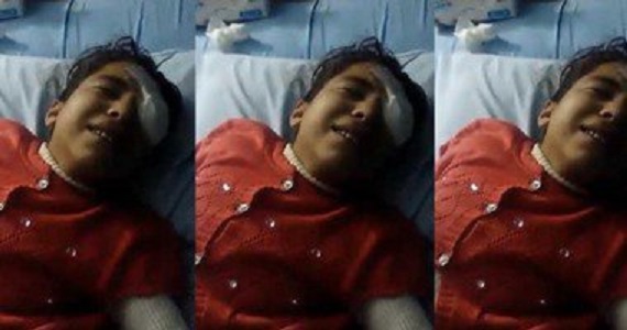 معلمة مصرية تفقأ عين تلميذة