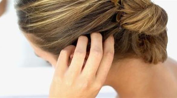 4 ظروف صحية تسبب حكة فروة